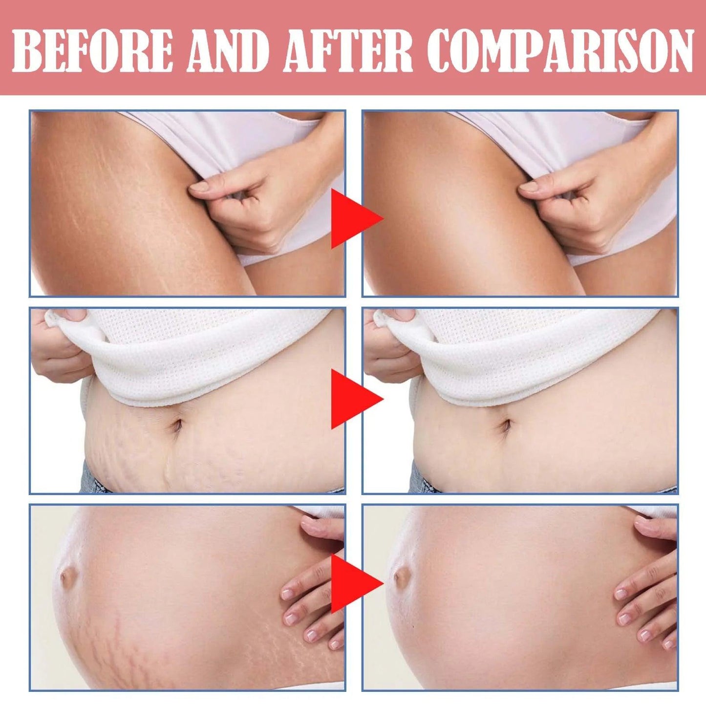 Maternity Scar Repair Essential Oil Pregnancy Lift Stretch Mark Remove Enhance Skin Care Elasticity Firm Sagging Deep Moisturize